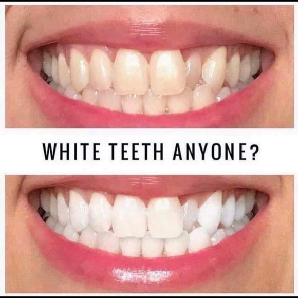 Whitening Toothpaste 🦷 - Picture 7 of 8